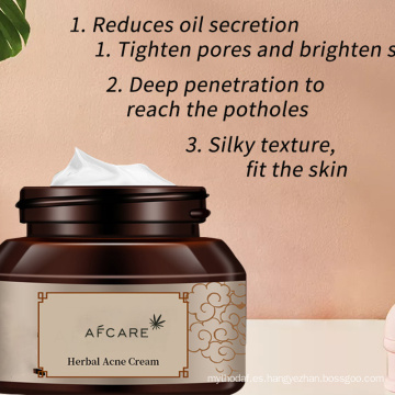 Crema para eliminar el acné a base de hierbas Meiyanqiong / Crema antiacné / Crema para eliminar las cicatrices del acné Crema blanqueadora coreana